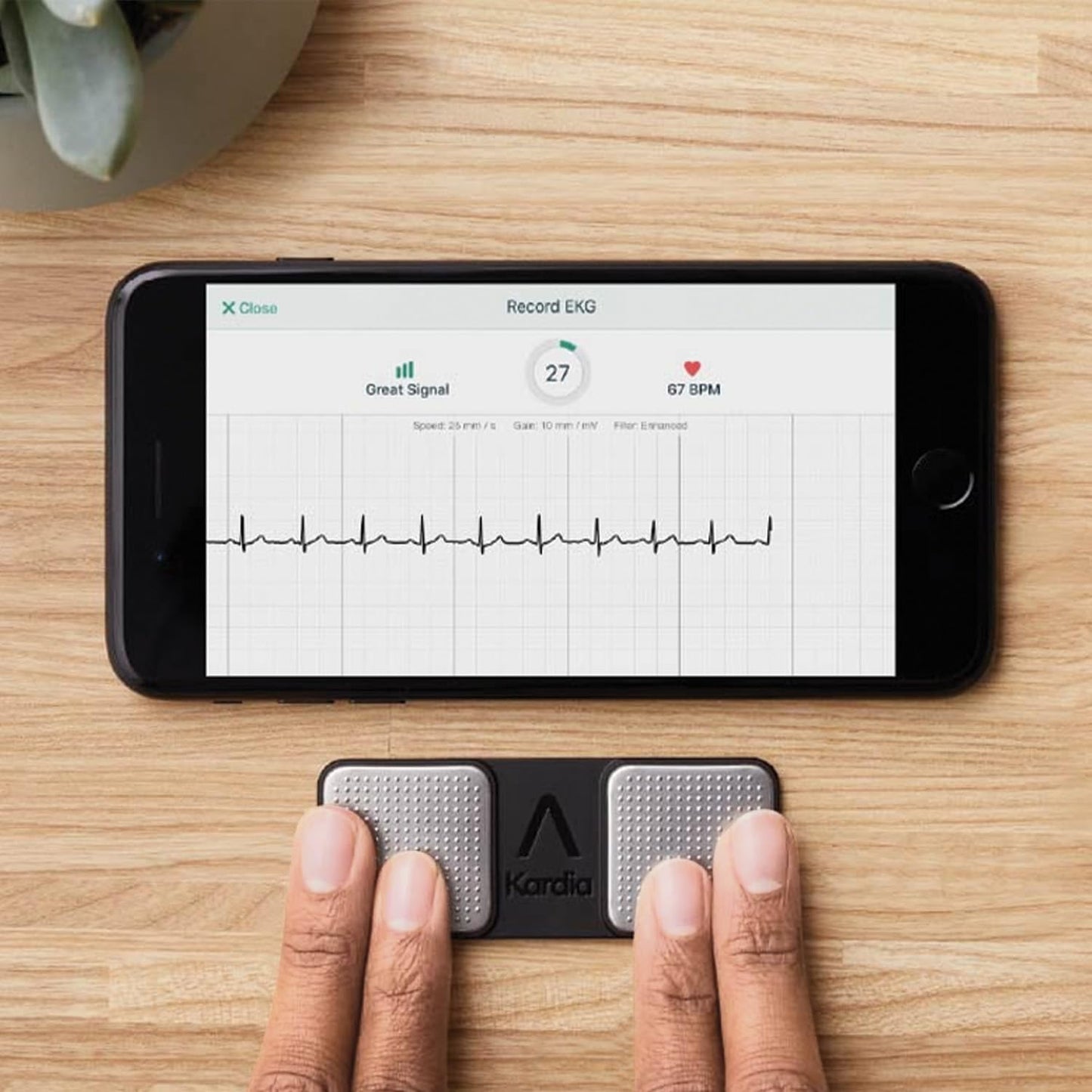 KardiaMobile 1-Lead Personal EKG Monitor – Record EKGs at Home – Detects AFib and Irregular Arrhythmias – Instant Results in 30 Seconds – Easy to Use – Works with Most Smartphones - FSA/HSA Eligible